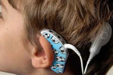 Cochlear Implant Surgery in India, Best ENT Surgery Centre in Gurgaon India, Best Centre for Cochlear Implant Surgery in Gurgaon India